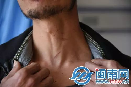 韩董庄镇草坡村村支书打人事件_郑州升龙又一城保安殴打村民_村民被村支书打住院