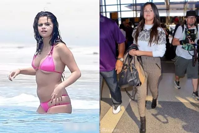 肥胖暴病，向死而后生，分手之后强大自己是我做过最好的事｜Selena Gomez