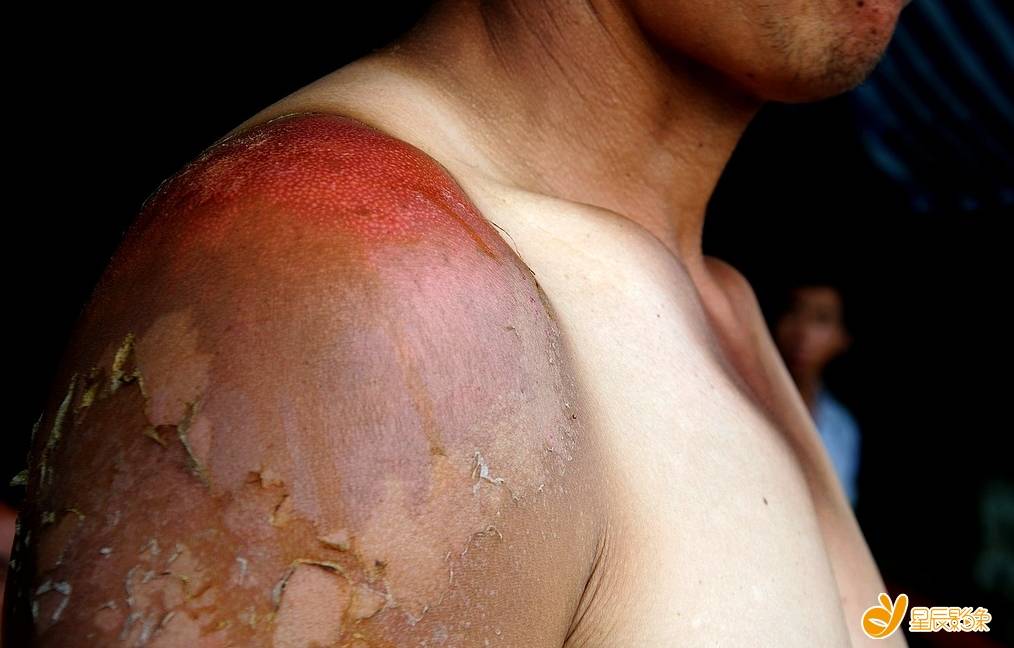 【点击查看原图】