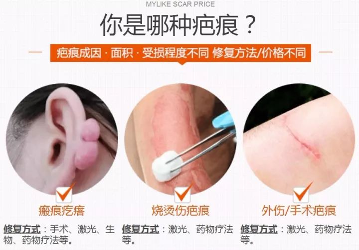 疤痕修复