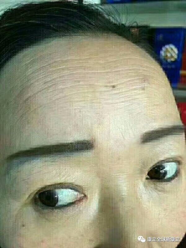 康立康医视负离子眼镜~ 病例反馈_康立负离子眼镜_新康立健康产业有限公司 康立康医视负离子眼镜~ 病例反馈_康立负离子眼镜_2017-10-1 15:31