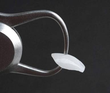 昆明瓷贴面牙齿美白,让您展现唇红齿白的自信