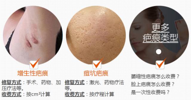 疤痕修复