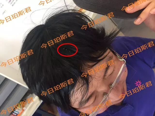 独家:澳华裔女店主勇斗持刀劫匪头破血流! 负伤次日照常营业社区支持! - 9